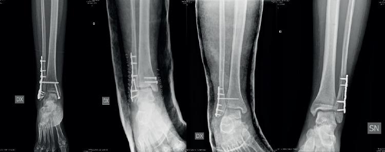 https://cdn.ncbi.nlm.nih.gov/pmc/blobs/028f/5585791/8740afc6f21d/MA-71-265-g001.jpg