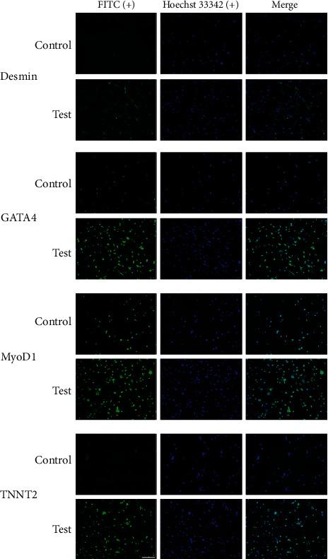 https://cdn.ncbi.nlm.nih.gov/pmc/blobs/028f/8105102/26f434d03ad9/SCI2021-8882264.003.jpg