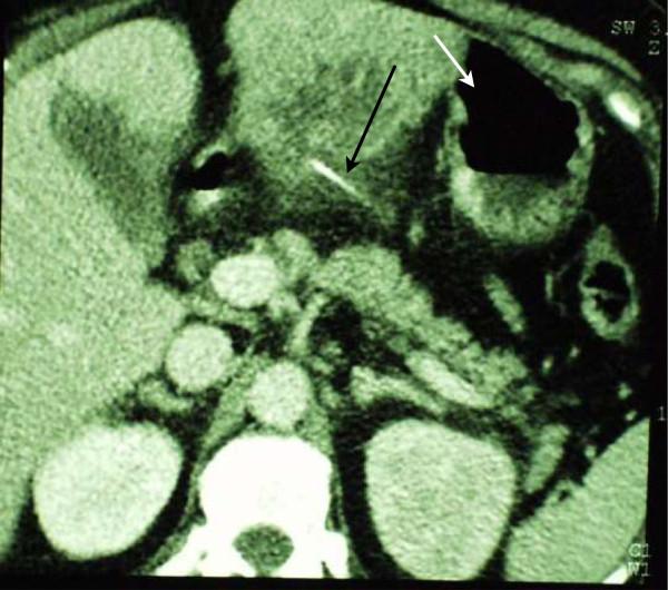 https://cdn.ncbi.nlm.nih.gov/pmc/blobs/0296/4190479/413122fdef6f/12876_2014_1191_Fig2_HTML.jpg