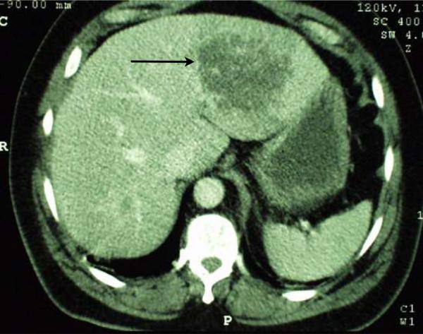 https://cdn.ncbi.nlm.nih.gov/pmc/blobs/0296/4190479/9ed04f074fa9/12876_2014_1191_Fig1_HTML.jpg
