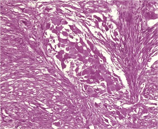 https://cdn.ncbi.nlm.nih.gov/pmc/blobs/0299/5909463/4b28d46c8368/omy006f07.jpg