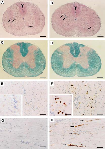https://cdn.ncbi.nlm.nih.gov/pmc/blobs/02a6/2118456/d49f731b13be/jem2042363f03.jpg