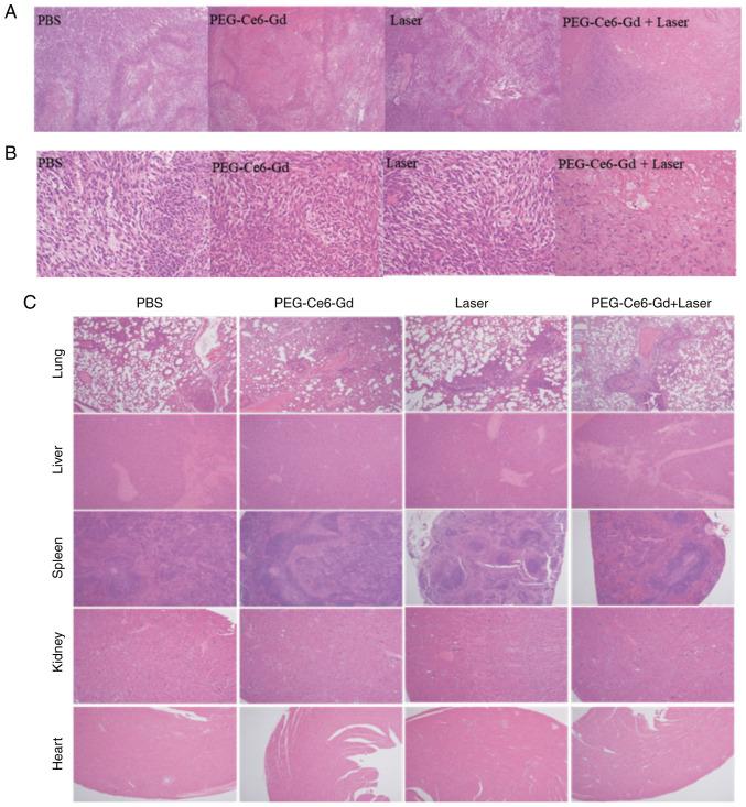 https://cdn.ncbi.nlm.nih.gov/pmc/blobs/02a8/7757081/96ba2a8a5f2e/OR-45-02-0547-g07.jpg