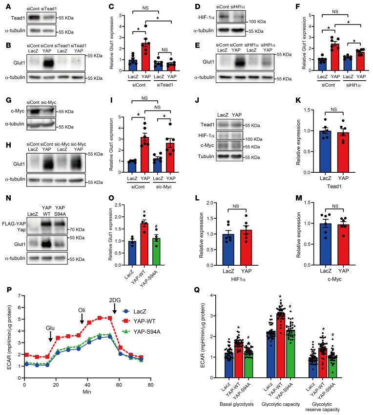 https://cdn.ncbi.nlm.nih.gov/pmc/blobs/02aa/8920343/7e1e3e2d0ed9/jci-132-150595-g023.jpg