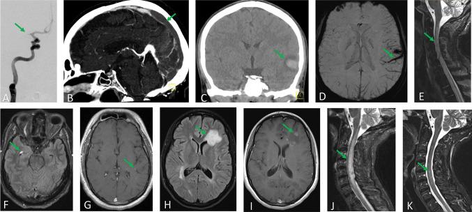 https://cdn.ncbi.nlm.nih.gov/pmc/blobs/02b0/9606200/540219673dbd/13311_2022_1267_Fig1_HTML.jpg