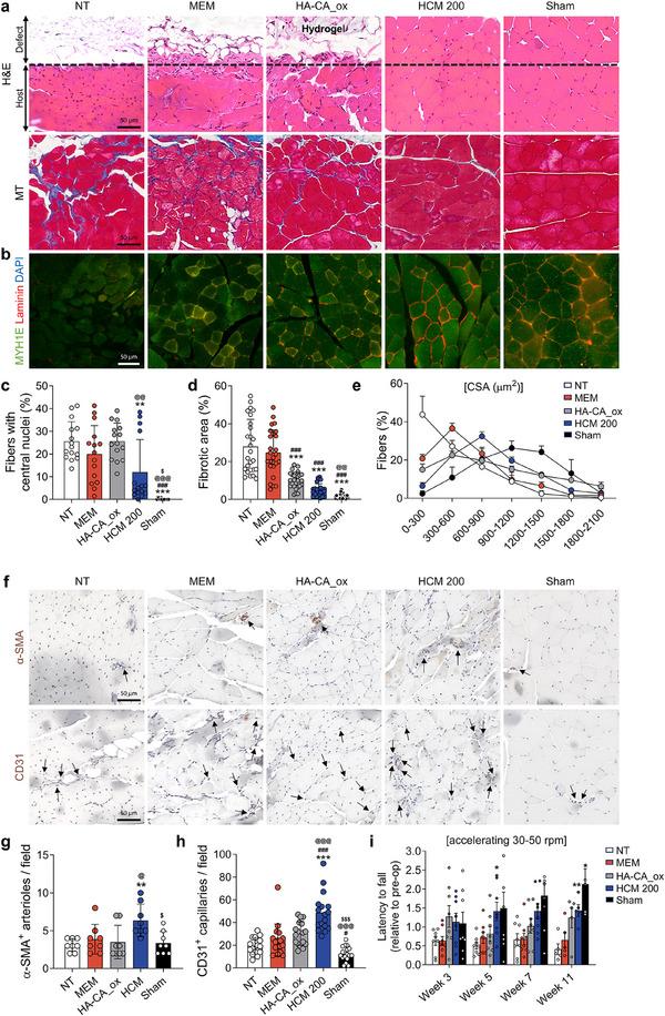 https://cdn.ncbi.nlm.nih.gov/pmc/blobs/02b1/12118333/7780bc36bfd0/ADHM-14-0-g007.jpg