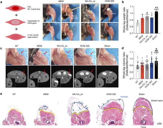 https://cdn.ncbi.nlm.nih.gov/pmc/blobs/02b1/12118333/c50118dda0f7/ADHM-14-0-g003.jpg