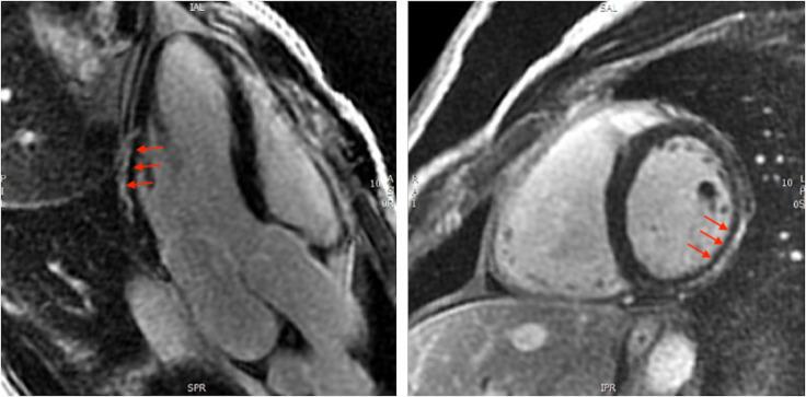 https://cdn.ncbi.nlm.nih.gov/pmc/blobs/02b8/12278148/86bc9f6f4a00/openhrt-12-2-g001.jpg