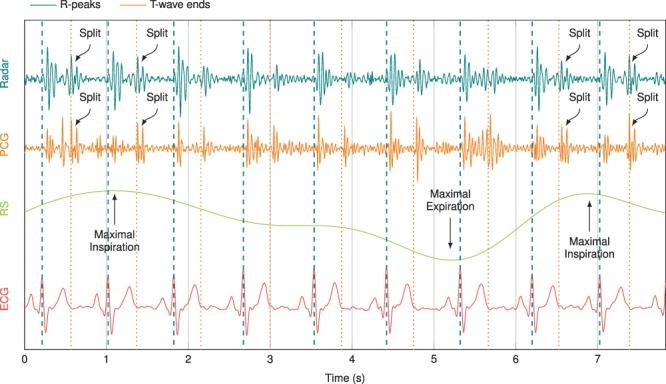 https://cdn.ncbi.nlm.nih.gov/pmc/blobs/02ba/6070547/76b5bdc6a334/41598_2018_29984_Fig4_HTML.jpg