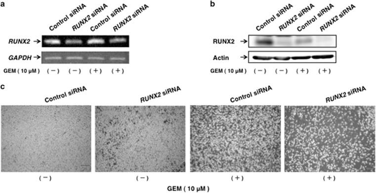 https://cdn.ncbi.nlm.nih.gov/pmc/blobs/02bb/4945741/0cc64bdaf94d/oncsis201640f3.jpg