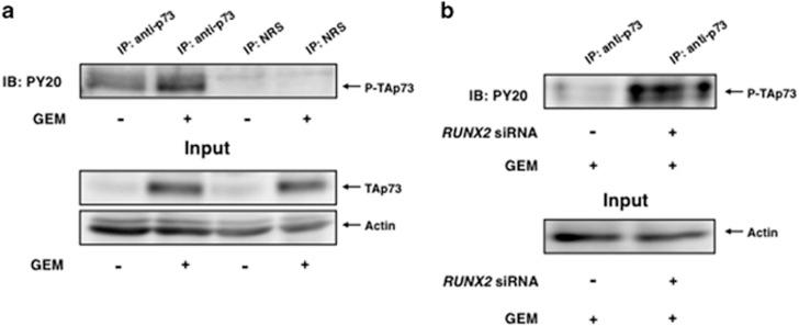 https://cdn.ncbi.nlm.nih.gov/pmc/blobs/02bb/4945741/2b046236b145/oncsis201640f8.jpg