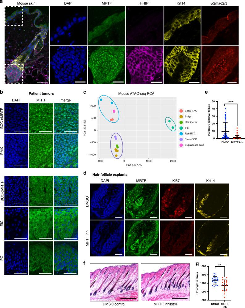 https://cdn.ncbi.nlm.nih.gov/pmc/blobs/02c2/7546632/36cc28f1a567/41467_2020_18762_Fig1_HTML.jpg