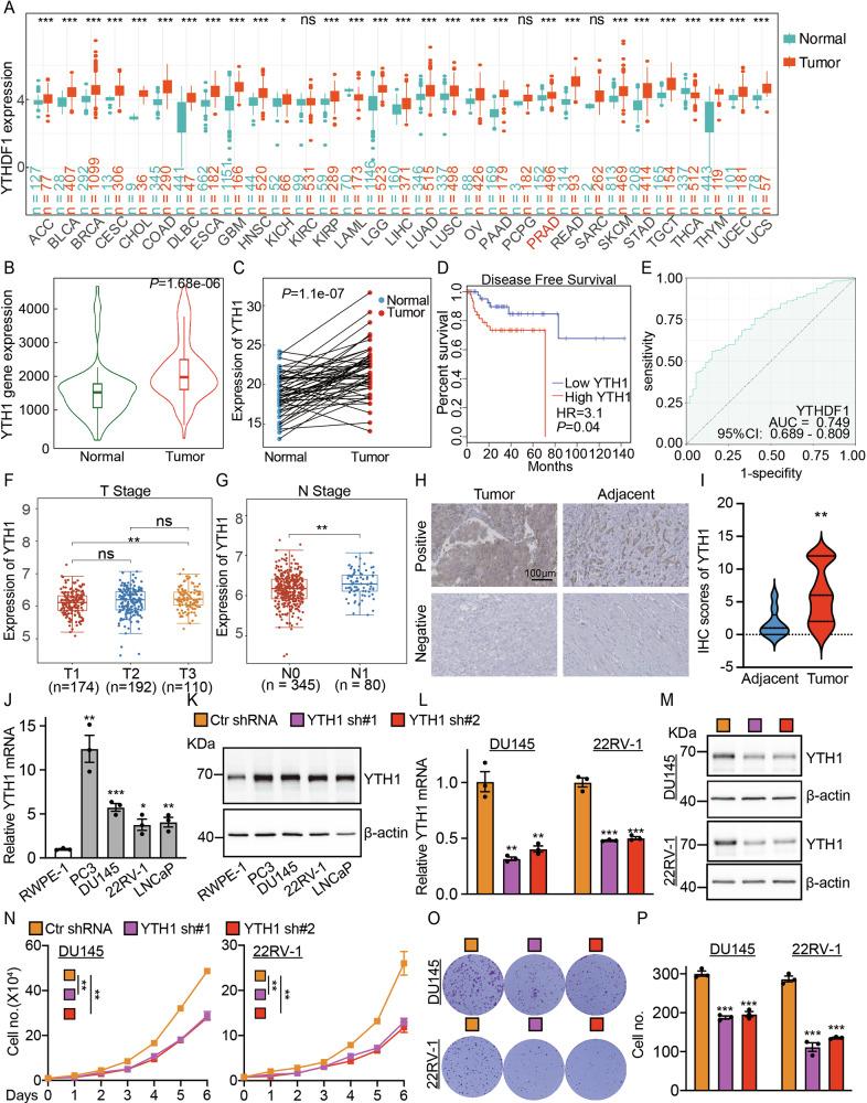 https://cdn.ncbi.nlm.nih.gov/pmc/blobs/02c4/12008233/42d20363788c/41419_2025_7648_Fig1_HTML.jpg