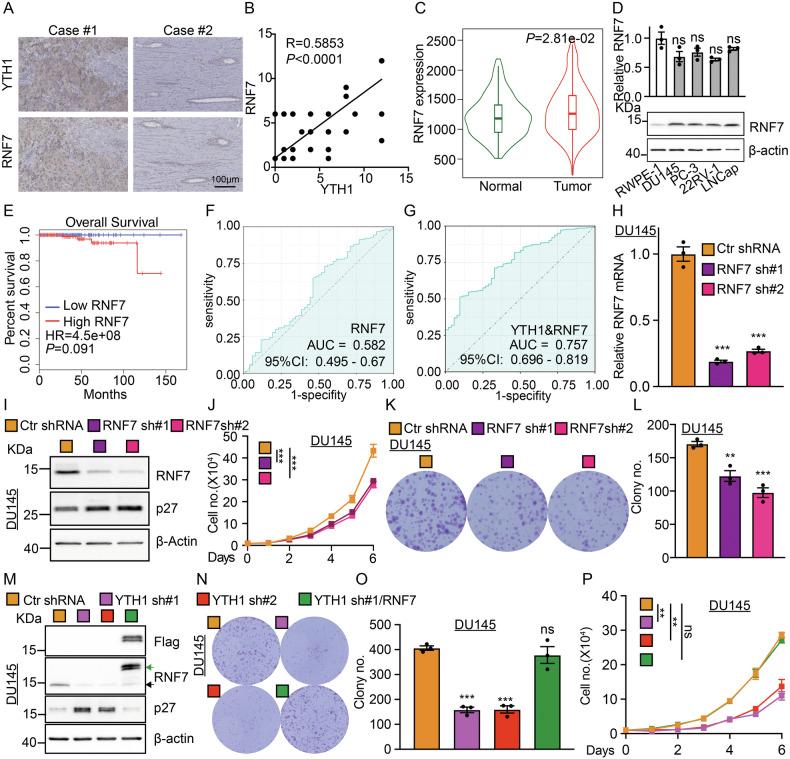 https://cdn.ncbi.nlm.nih.gov/pmc/blobs/02c4/12008233/75a0ec8a2bcf/41419_2025_7648_Fig4_HTML.jpg