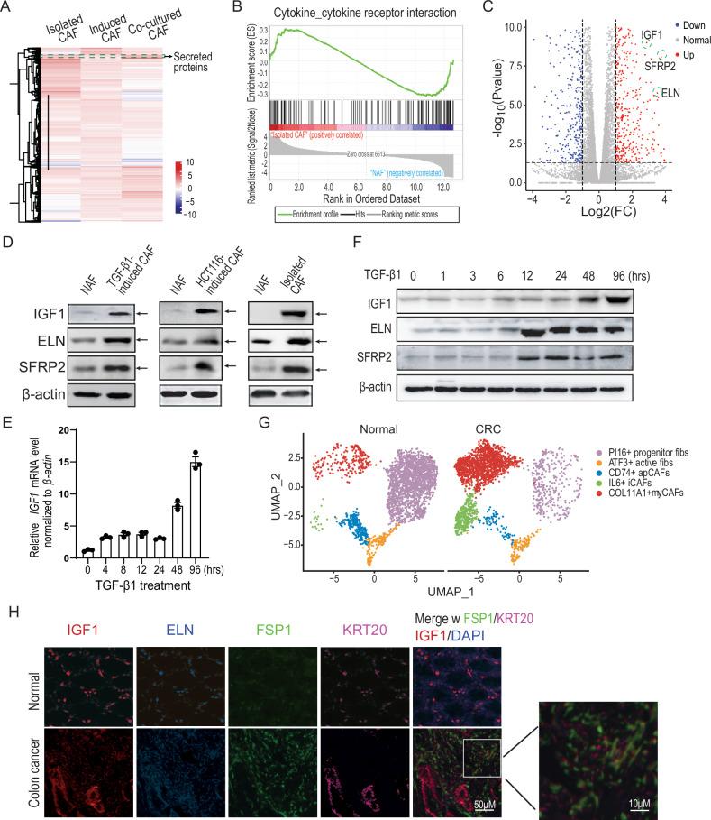 https://cdn.ncbi.nlm.nih.gov/pmc/blobs/02c8/12259948/754b539a576b/41419_2025_7818_Fig1_HTML.jpg
