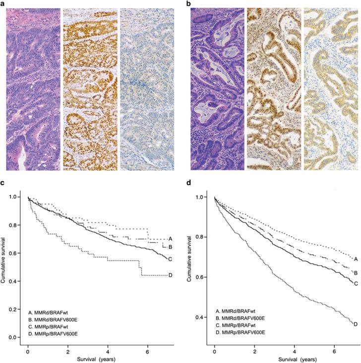 https://cdn.ncbi.nlm.nih.gov/pmc/blobs/02c8/4021849/d06ddeaca542/modpathol2013200f1.jpg