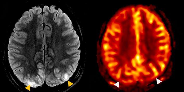 https://cdn.ncbi.nlm.nih.gov/pmc/blobs/02cd/9119826/c615584d00f7/gr3.jpg