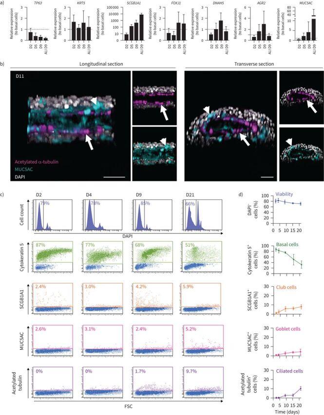 https://cdn.ncbi.nlm.nih.gov/pmc/blobs/02d4/11627163/9cf632e5a70a/ERJ-00562-2024.03.jpg