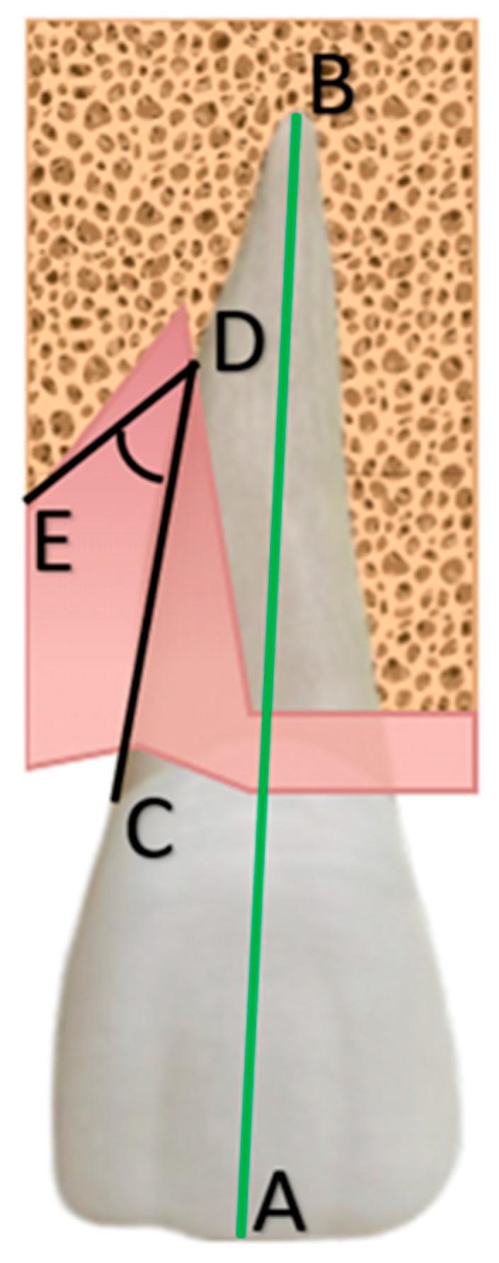 https://cdn.ncbi.nlm.nih.gov/pmc/blobs/02d8/11313186/ec8252d6db13/jcm-13-04315-g002.jpg