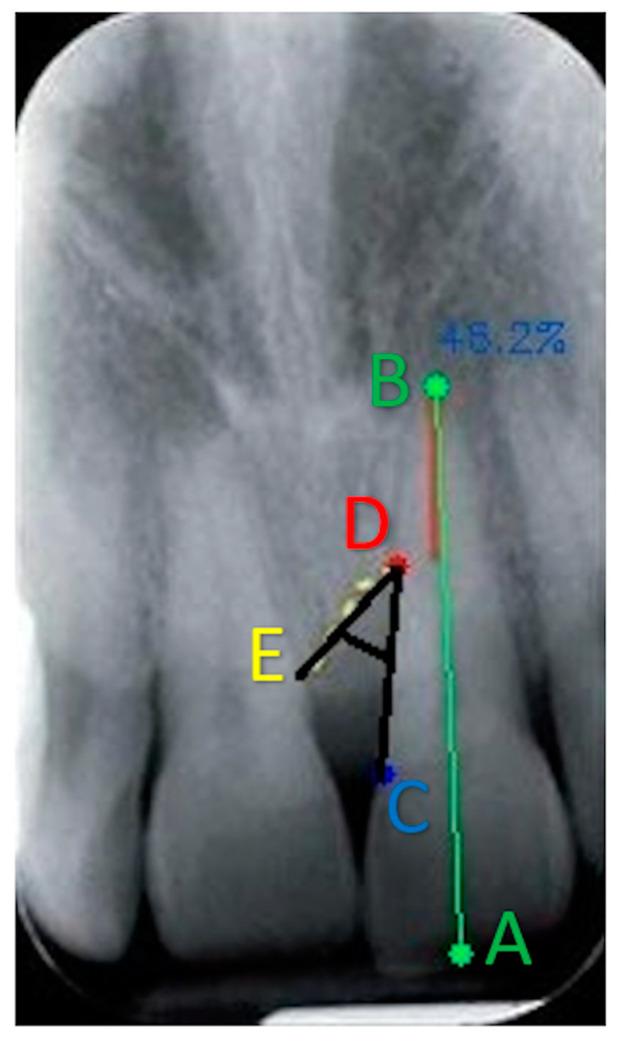 https://cdn.ncbi.nlm.nih.gov/pmc/blobs/02d8/11313186/f566f8e11c42/jcm-13-04315-g003.jpg