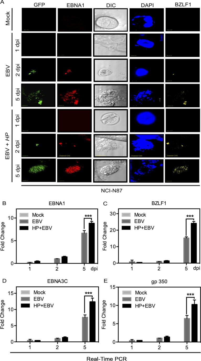 https://cdn.ncbi.nlm.nih.gov/pmc/blobs/02dd/5915740/5720a669fbfa/mbo0021838570002.jpg