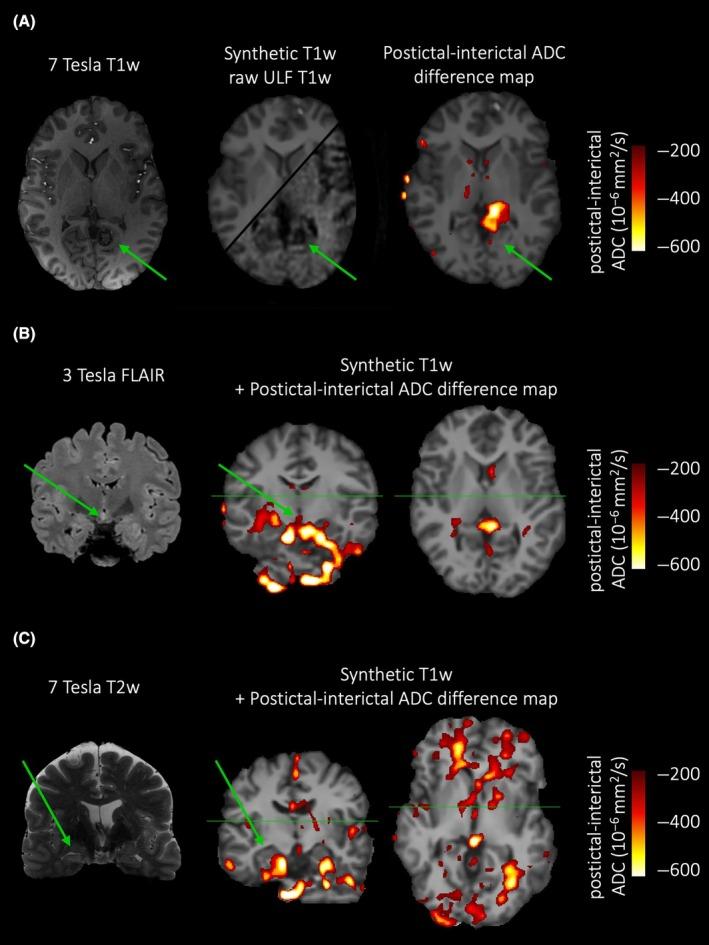 https://cdn.ncbi.nlm.nih.gov/pmc/blobs/02df/11997907/512015238c80/EPI-66-e60-g001.jpg