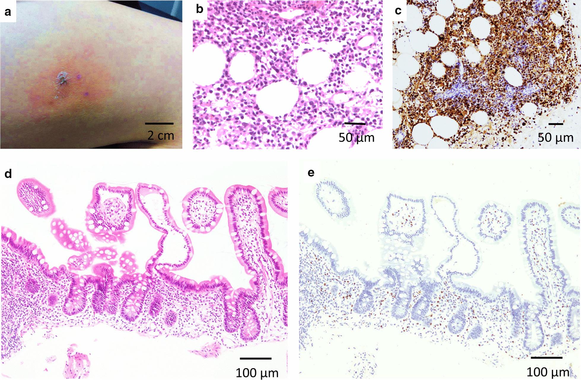 https://cdn.ncbi.nlm.nih.gov/pmc/blobs/02ea/7789587/5c1ee893fb7c/12876_2020_1589_Fig4_HTML.jpg