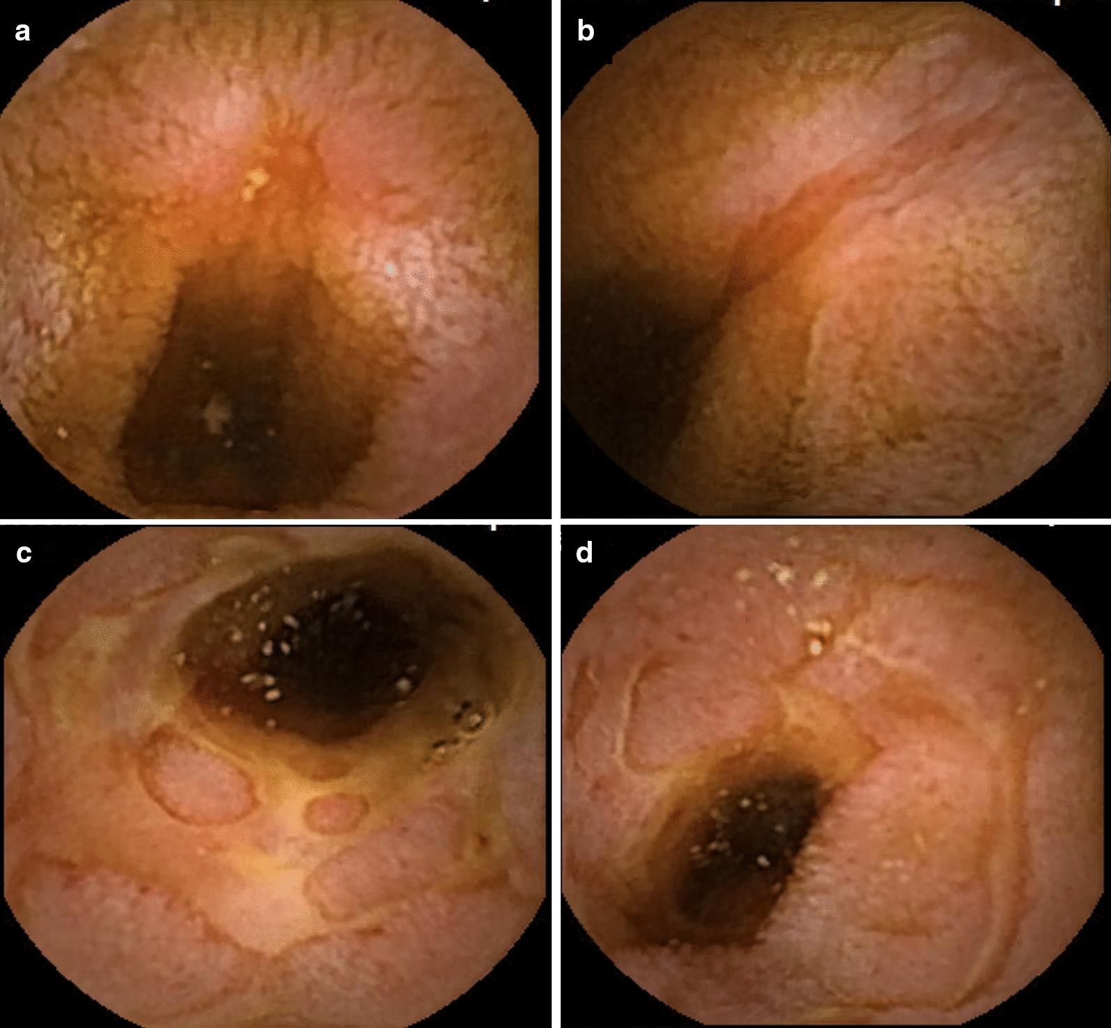 https://cdn.ncbi.nlm.nih.gov/pmc/blobs/02ea/7789587/92d9a53886b3/12876_2020_1589_Fig1_HTML.jpg