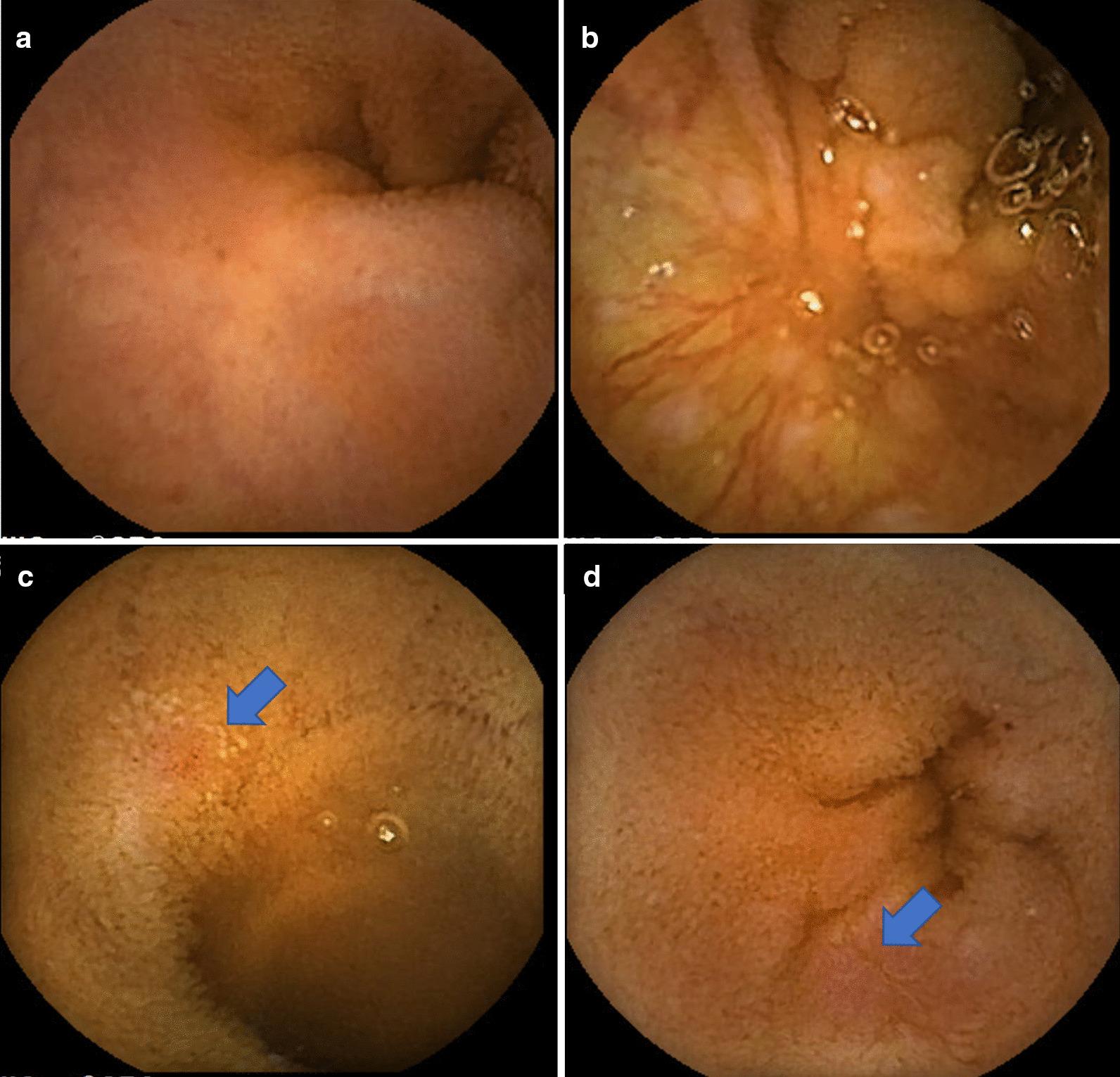 https://cdn.ncbi.nlm.nih.gov/pmc/blobs/02ea/7789587/d9d95897e1fb/12876_2020_1589_Fig3_HTML.jpg