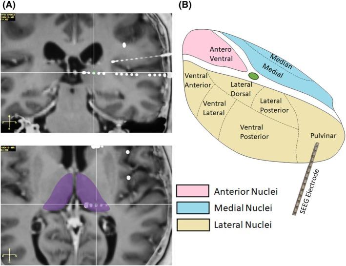https://cdn.ncbi.nlm.nih.gov/pmc/blobs/02ef/12371610/d565823f2b2f/EPI-66-2690-g004.jpg
