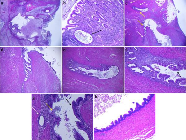 https://cdn.ncbi.nlm.nih.gov/pmc/blobs/02ef/4001424/cf04e07743e5/1746-1596-9-39-1.jpg
