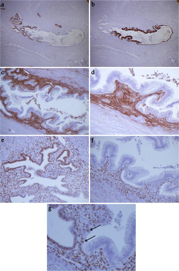 https://cdn.ncbi.nlm.nih.gov/pmc/blobs/02ef/4001424/f7ade3277a76/1746-1596-9-39-2.jpg