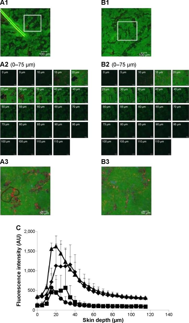 https://cdn.ncbi.nlm.nih.gov/pmc/blobs/02ff/4514352/7c581808eab6/ijn-10-4581Fig5.jpg