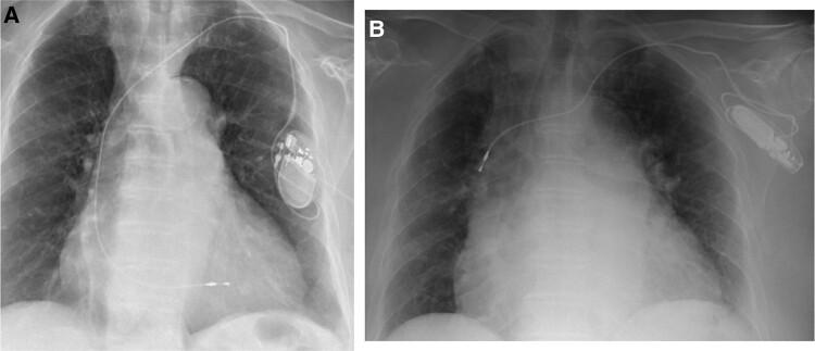https://cdn.ncbi.nlm.nih.gov/pmc/blobs/0306/10794872/8a625c636033/ytae004f2.jpg