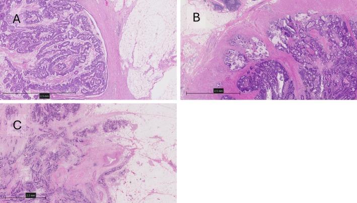 https://cdn.ncbi.nlm.nih.gov/pmc/blobs/0308/12081161/eac73e92a4d6/CJP2-11-e70031-g003.jpg