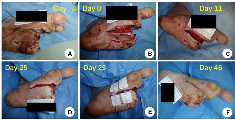 https://cdn.ncbi.nlm.nih.gov/pmc/blobs/030f/8352599/64956d4901dd/DMSO-14-3523-g0001.jpg