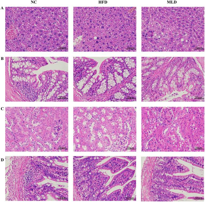 https://cdn.ncbi.nlm.nih.gov/pmc/blobs/0313/12088948/1f88c8e5daf9/fnut-12-1580439-g0003.jpg