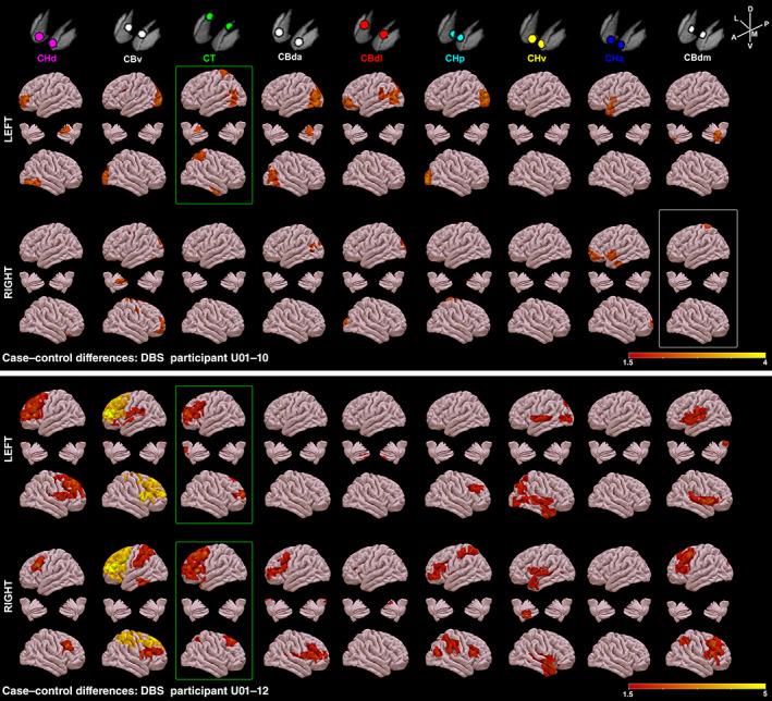https://cdn.ncbi.nlm.nih.gov/pmc/blobs/0317/8720198/0f3a07a7825a/HBM-43-633-g001.jpg