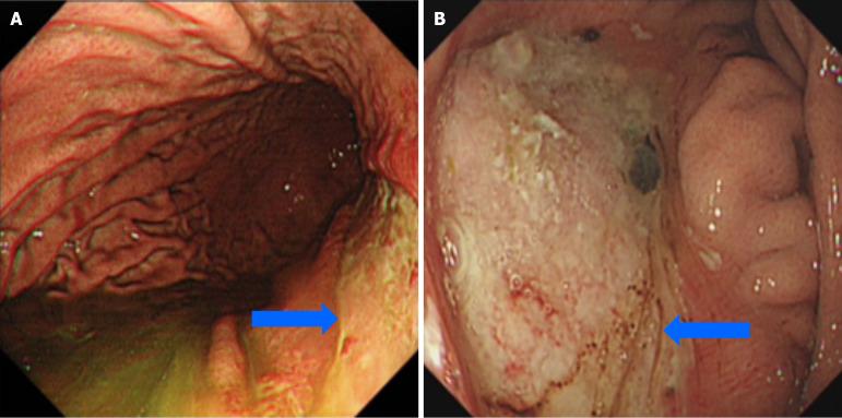 https://cdn.ncbi.nlm.nih.gov/pmc/blobs/0323/11287677/494a8ac1ab53/WJGS-16-2337-g004.jpg