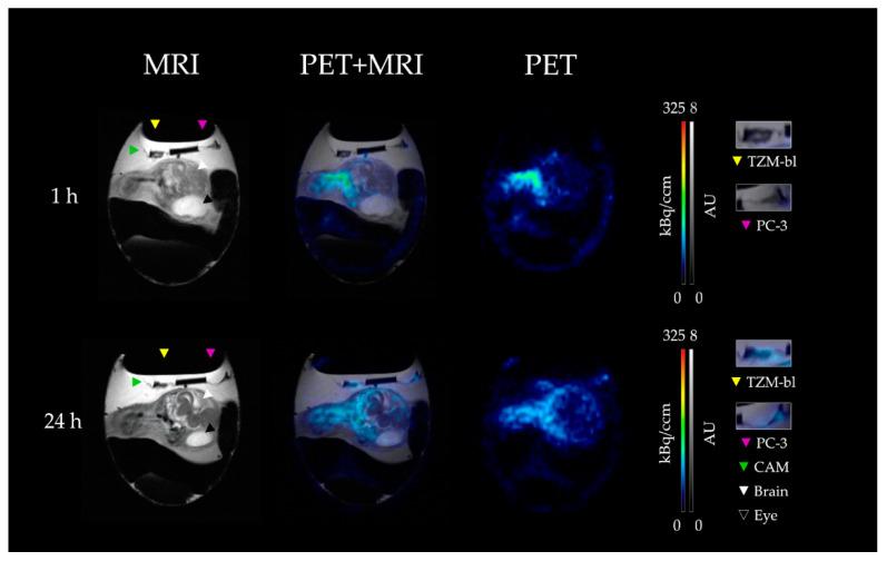 https://cdn.ncbi.nlm.nih.gov/pmc/blobs/0323/9954539/0fae2e67b6f1/cancers-15-01126-g002.jpg
