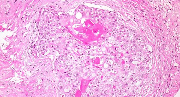 https://cdn.ncbi.nlm.nih.gov/pmc/blobs/0324/2644692/317f17d59638/1477-7819-7-16-5.jpg
