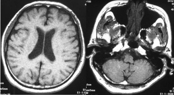 https://cdn.ncbi.nlm.nih.gov/pmc/blobs/0324/2644692/8eea5e6ff5d3/1477-7819-7-16-6.jpg