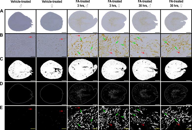 https://cdn.ncbi.nlm.nih.gov/pmc/blobs/032b/11194050/2f49d6a61eab/ajprenal.00140.2023_f004.jpg