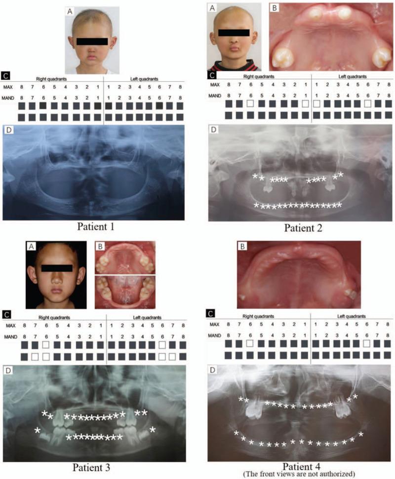 https://cdn.ncbi.nlm.nih.gov/pmc/blobs/032f/7220389/461324c66e10/medi-99-e19244-g001.jpg