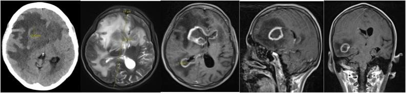 https://cdn.ncbi.nlm.nih.gov/pmc/blobs/0335/8022152/59c3334fde90/gr1.jpg