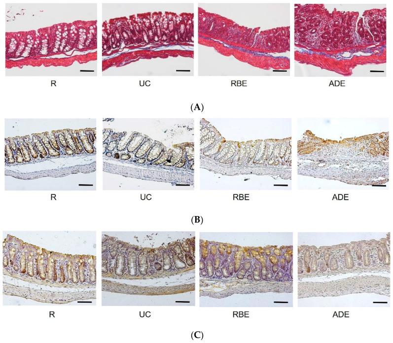 https://cdn.ncbi.nlm.nih.gov/pmc/blobs/0335/9506450/99bcb9462ece/nutrients-14-03877-g002a.jpg
