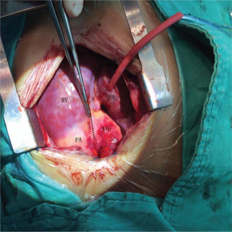 https://cdn.ncbi.nlm.nih.gov/pmc/blobs/0341/5690786/81fab105cb37/medi-96-e8614-g001.jpg