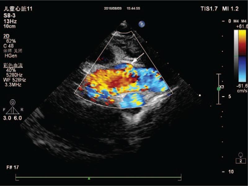 https://cdn.ncbi.nlm.nih.gov/pmc/blobs/0341/5690786/98c3baab61c9/medi-96-e8614-g003.jpg