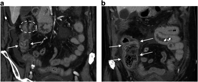 https://cdn.ncbi.nlm.nih.gov/pmc/blobs/0345/12058634/1946f680c8fc/13244_2025_1955_Fig3_HTML.jpg