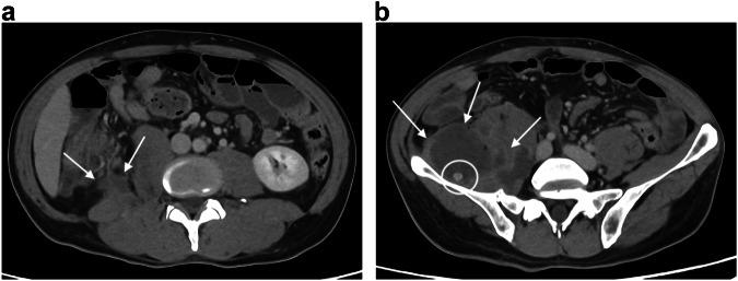 https://cdn.ncbi.nlm.nih.gov/pmc/blobs/0345/12058634/c0b837b88e9b/13244_2025_1955_Fig10_HTML.jpg